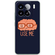 Чохол BoxFace Xiaomi 15 