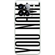 Чохол BoxFace Xiaomi 15 