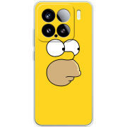 Чохол BoxFace Xiaomi 15 