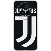 Чохол BoxFace Realme 14 Pro 5G FC J
