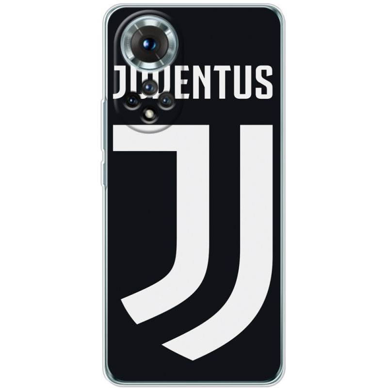 Чохол BoxFace Honor 50 FC J