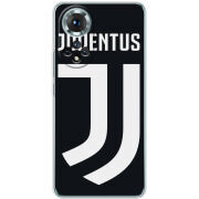 Чохол BoxFace Honor 50 FC J