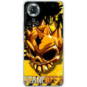 Чохол BoxFace Honor 50 StandOff 2 gold