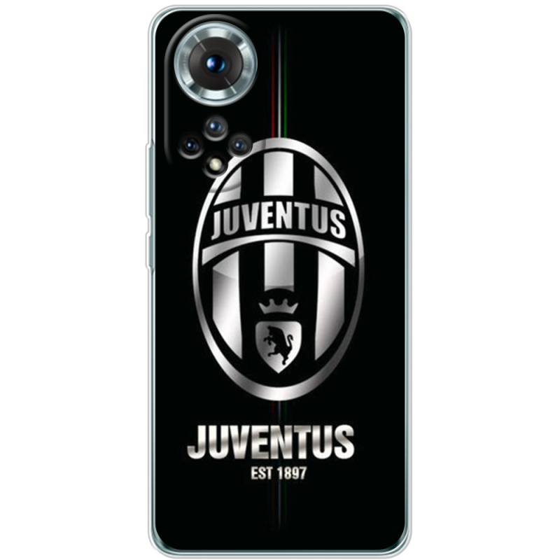 Чохол BoxFace Honor 50 