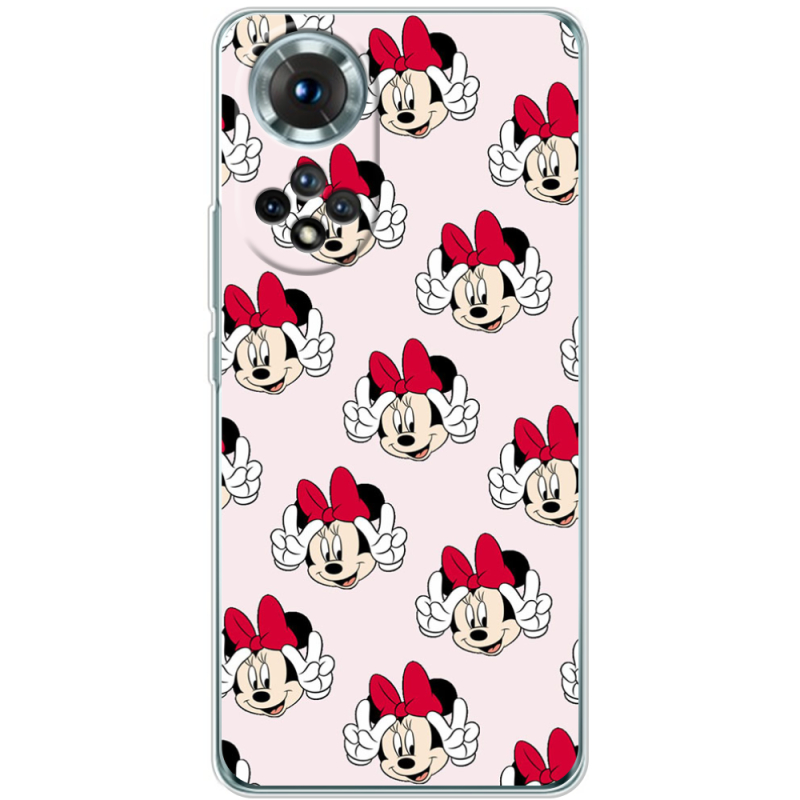 Чохол BoxFace Honor 50 