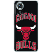 Чохол BoxFace Honor 50 