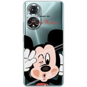 Прозорий чохол BoxFace Honor 50 Mister M