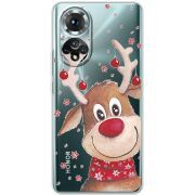 Прозорий чохол BoxFace Honor 50 Winter Deer