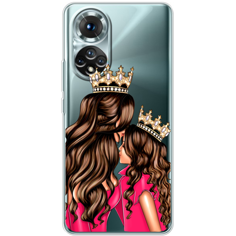 Прозорий чохол BoxFace Honor 50 Queen and Princess