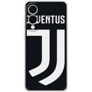 Чохол BoxFace Samsung Galaxy S25 Edge FC J