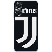 Чохол BoxFace Realme Note 60x FC J