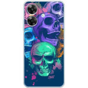 Чохол BoxFace Realme Note 60x 