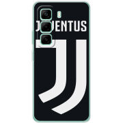 Чохол BoxFace Infinix Hot 50 Pro Plus FC J