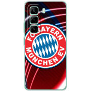 Чохол BoxFace Infinix Hot 50 Pro Plus 