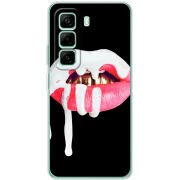 Чохол BoxFace Infinix Hot 50 Pro Plus 