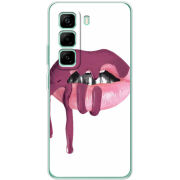 Чохол BoxFace Infinix Hot 50 Pro Plus 