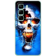 Чохол BoxFace Infinix Hot 50 Pro Plus 