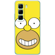 Чохол BoxFace Infinix Hot 50 Pro Plus 