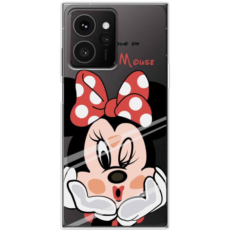 Прозорий чохол BoxFace HMD Skyline Lady M