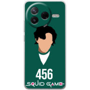 Чохол BoxFace Poco F7 Pro siquid game 456