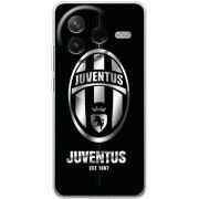 Чохол BoxFace Poco F7 Pro 