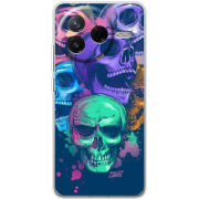 Чохол BoxFace Poco F7 Pro 