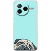 Чохол BoxFace Poco F7 Pro 