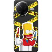 Чорний чохол BoxFace Poco F7 Pro White Bart