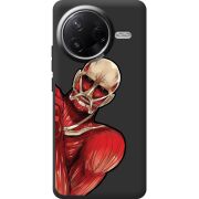 Чорний чохол BoxFace Poco F7 Pro Титан