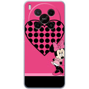 Чохол BoxFace Nubia V70 Max 