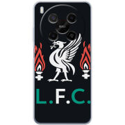 Чохол BoxFace Nubia V70 Max L. F. C.