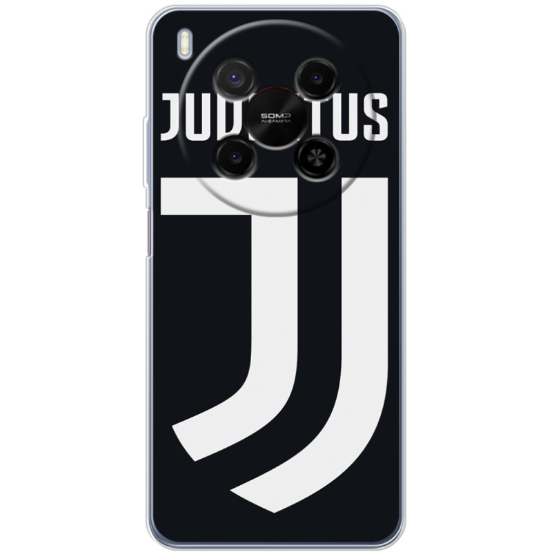 Чохол BoxFace Nubia V70 Max FC J