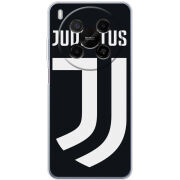 Чохол BoxFace Nubia V70 Max FC J