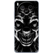 Чохол BoxFace Nubia V70 Max 