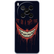 Чохол BoxFace Nubia V70 Max 