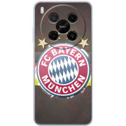 Чохол BoxFace Nubia V70 Max 