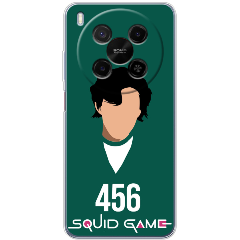 Чохол BoxFace Nubia V70 Max siquid game 456