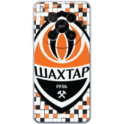 Чохол BoxFace Nubia V70 Max 