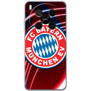 Чохол BoxFace Nubia V70 Max 