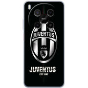 Чохол BoxFace Nubia V70 Max 