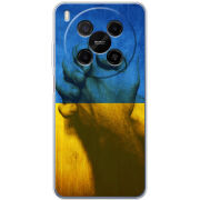 Чохол BoxFace Nubia V70 Max Handshake