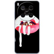 Чохол BoxFace Nubia V70 Max 