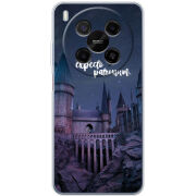 Чохол BoxFace Nubia V70 Max 