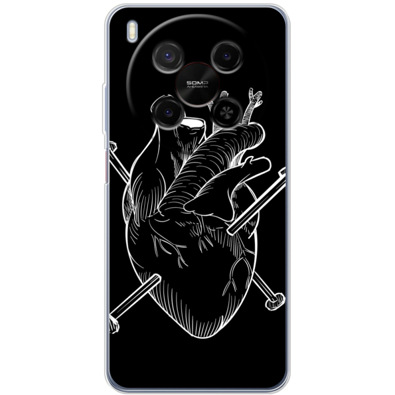 Чохол BoxFace Nubia V70 Max 