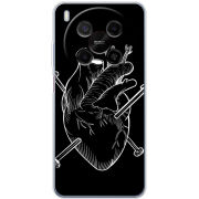 Чохол BoxFace Nubia V70 Max 