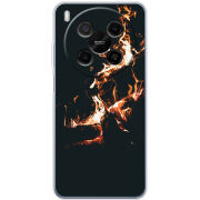 Чохол BoxFace Nubia V70 Max 