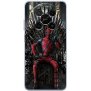 Чохол BoxFace Nubia V70 Max 