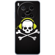 Чохол BoxFace Nubia V70 Max 