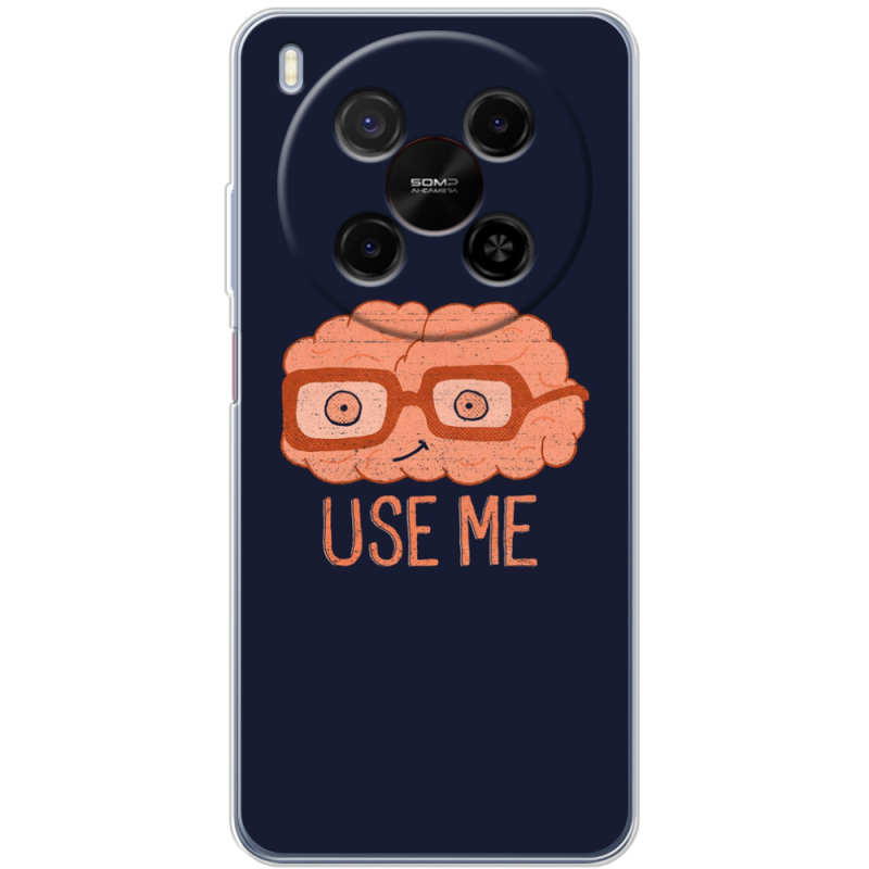 Чохол BoxFace Nubia V70 Max 