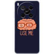 Чохол BoxFace Nubia V70 Max 